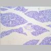 Pancreas SF 04.jpg
